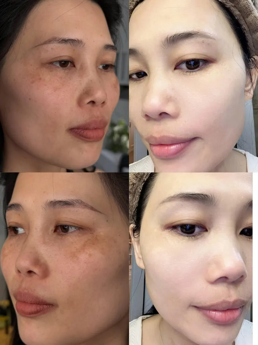 Ảnh trước và sau của khách hàng