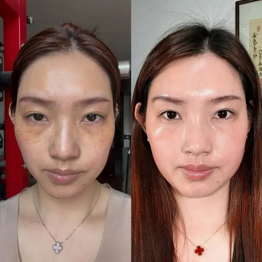 Ảnh trước và sau của khách hàng