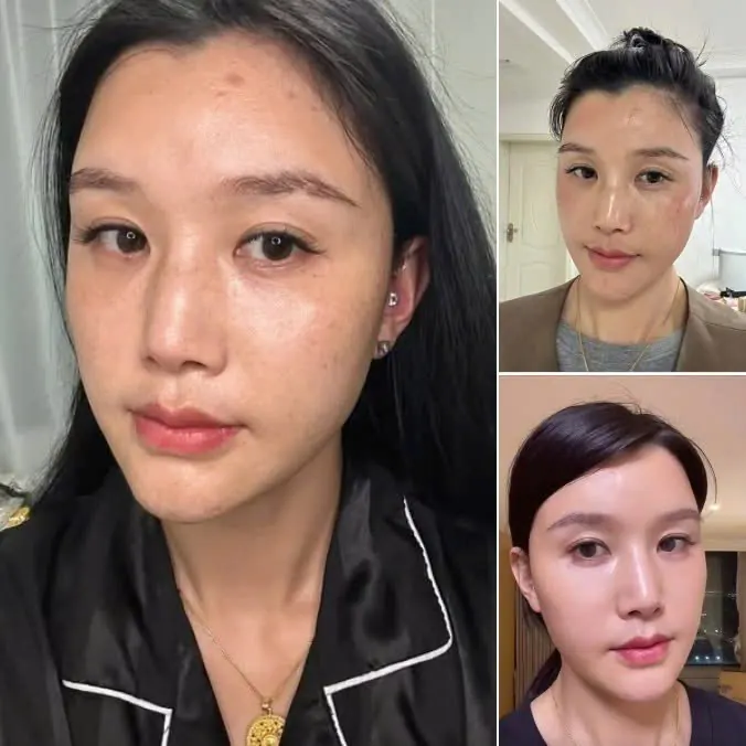 Ảnh trước và sau của khách hàng