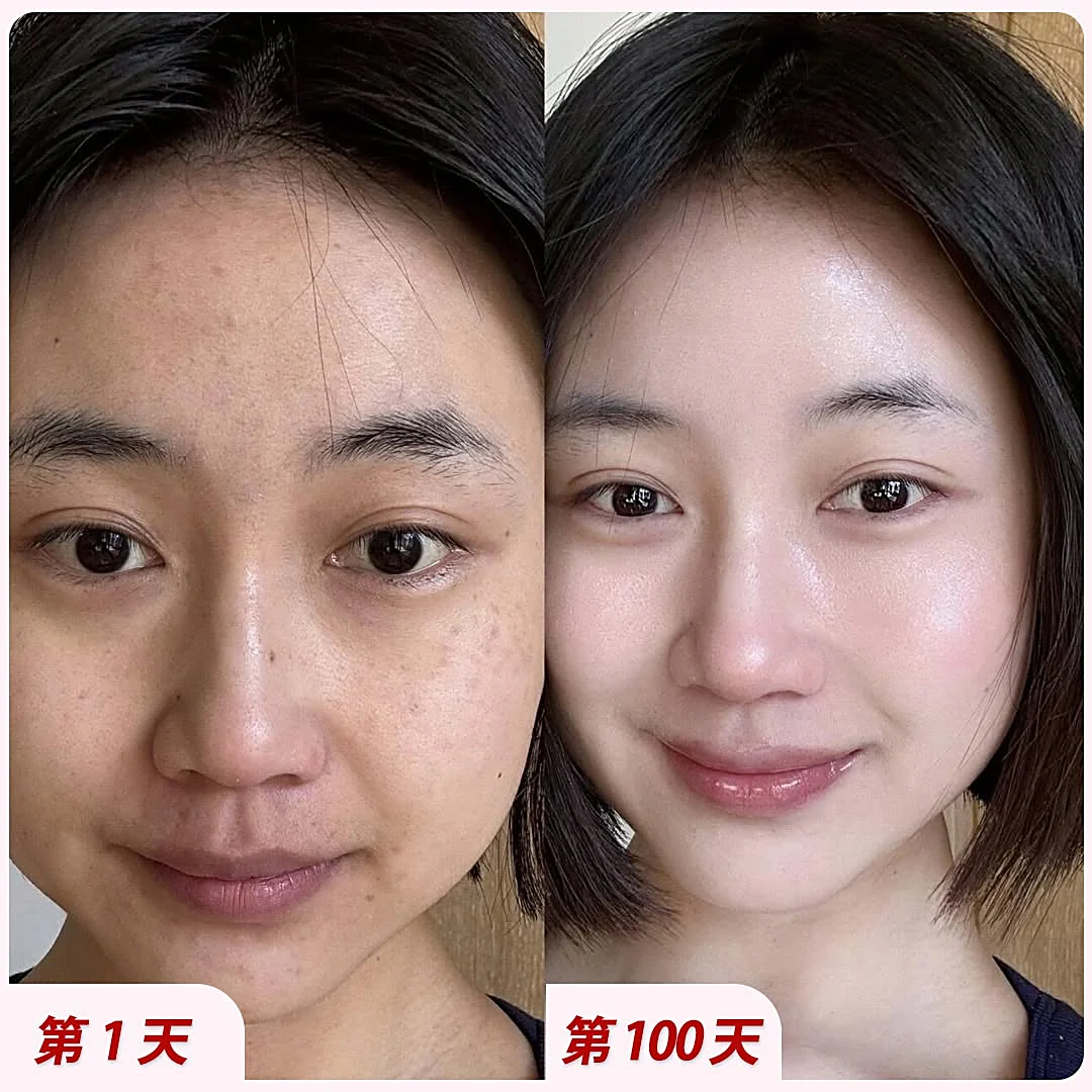 Ảnh trước và sau của khách hàng