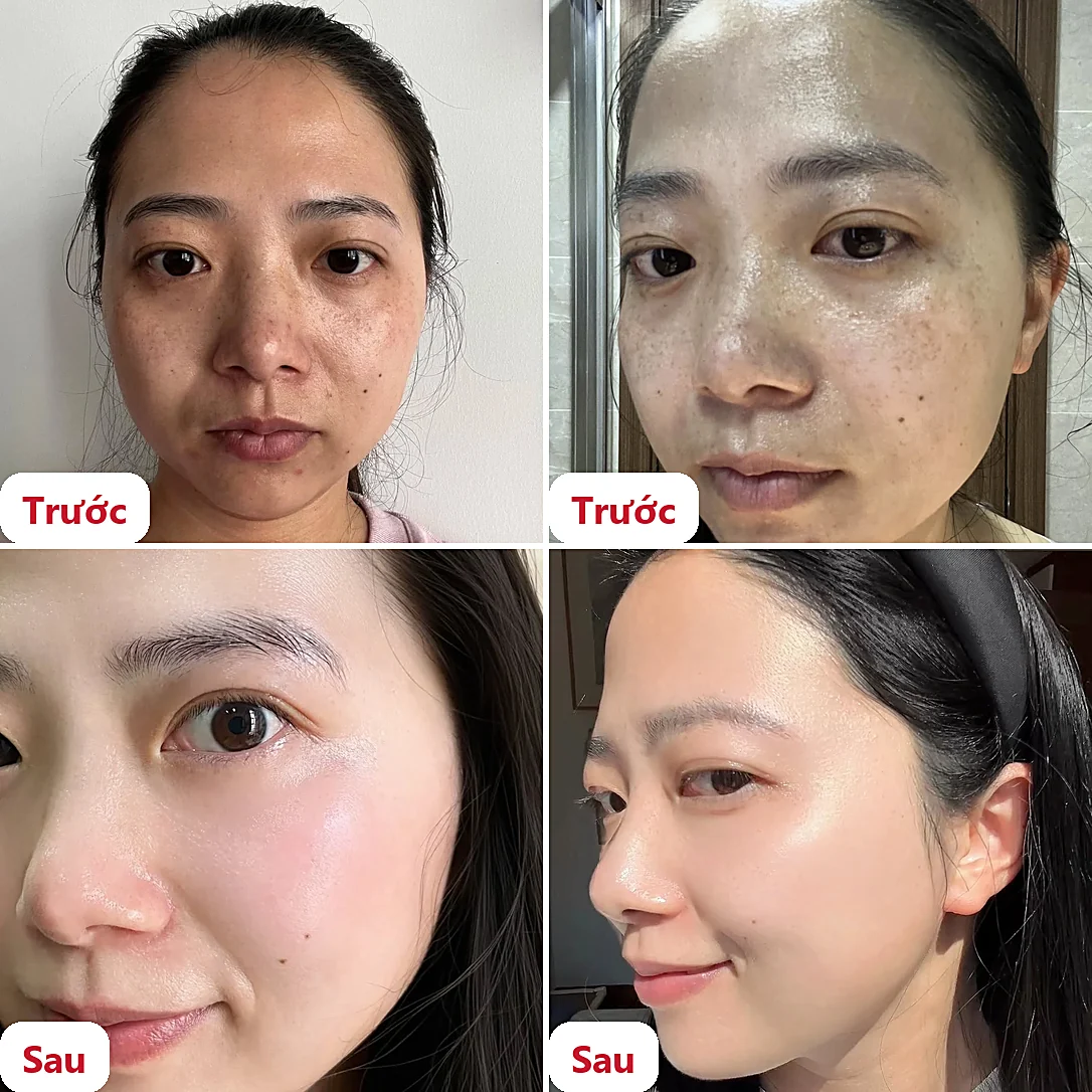 Ảnh trước và sau của khách hàng